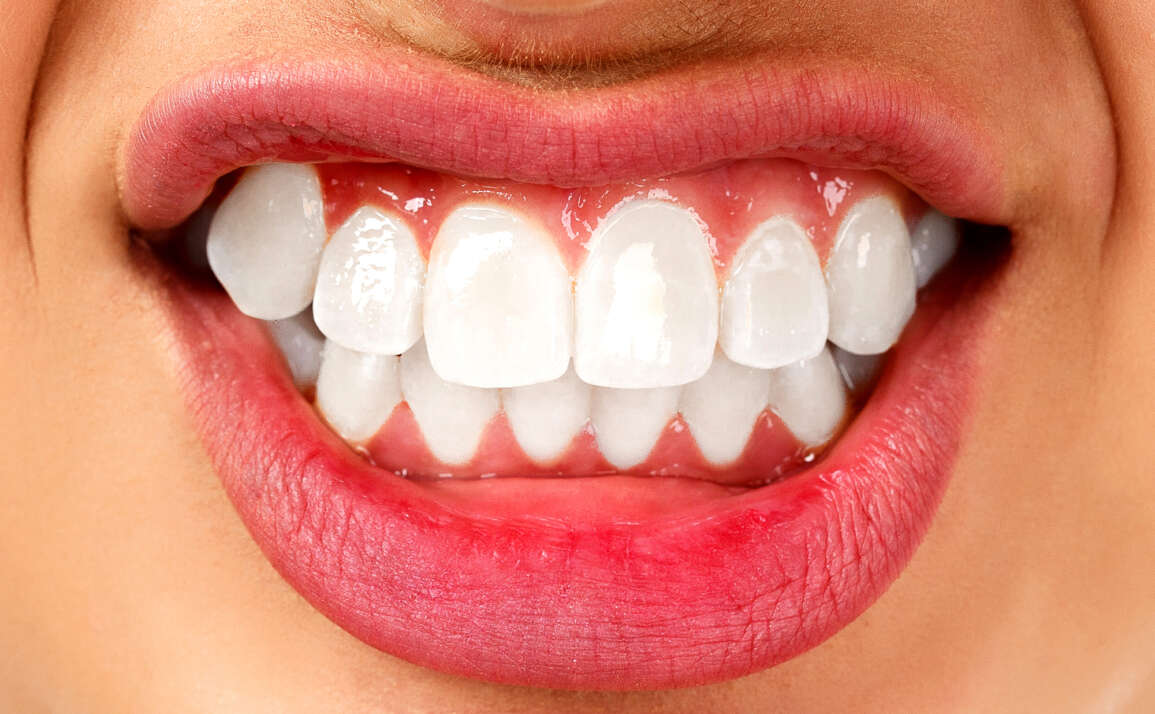 Škrípanie zubami: Ako to riešiť a odstrániť?